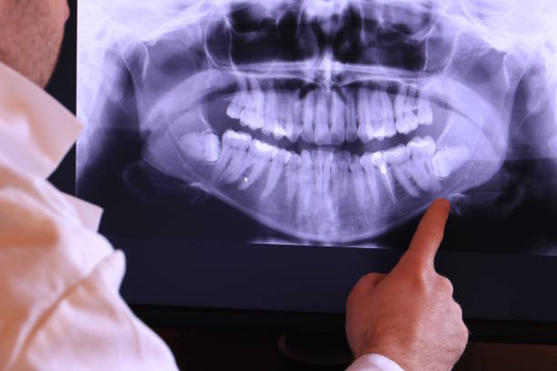 Best Emergency Denture Repair in Country Walk, FL