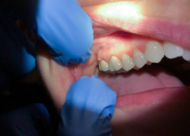 Best Cosmetic Emergency Dentistry in Country Walk, FL